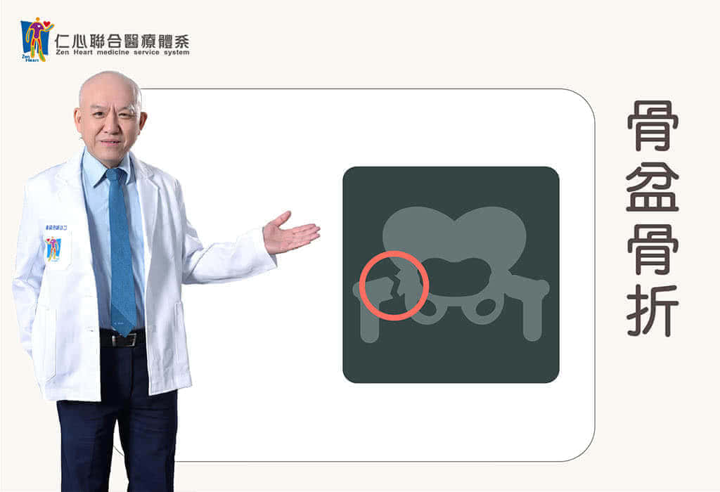 骨盤骨折